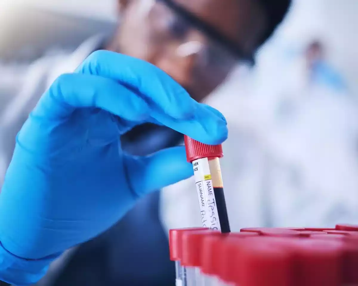 血液検査により、肥大型心筋症患者の合併症のリスクを予測することができます。